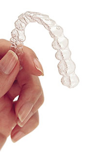 clear aligners